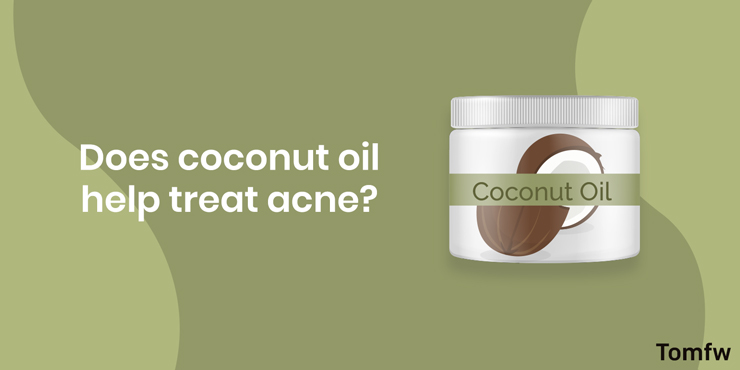 does coconut oil help treat acne?