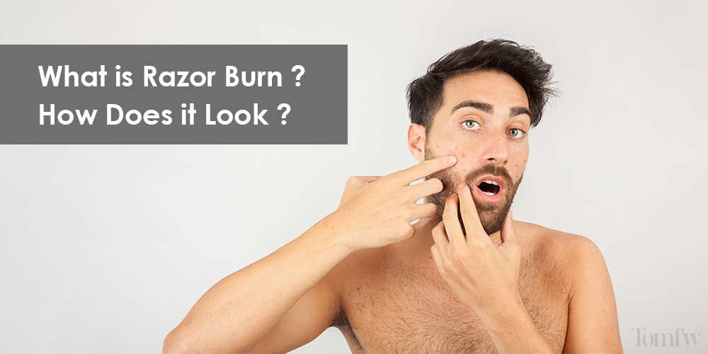 razor burn