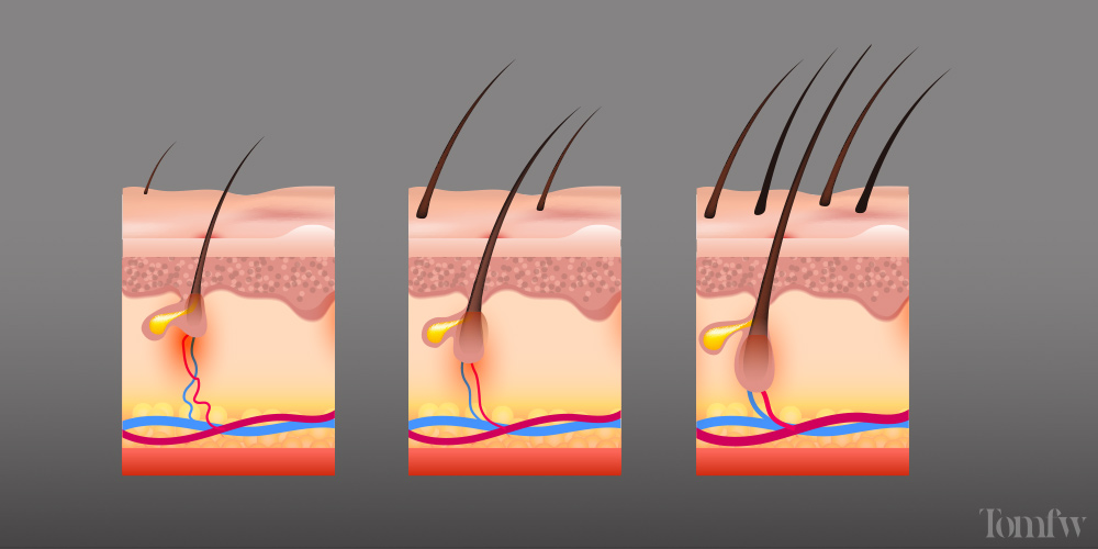 derma roller beard growth before and after