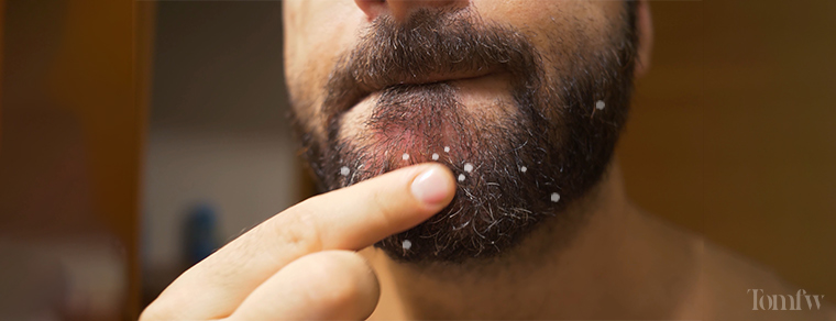 beard shampoo for dandruff